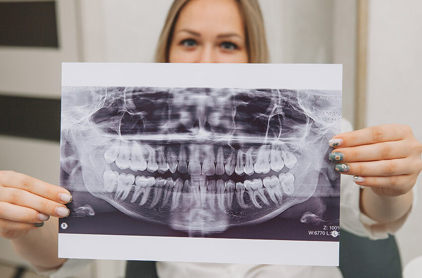 Patient beautiful girl is holding an x-ray of her teeth. medicine and dentistry concept.