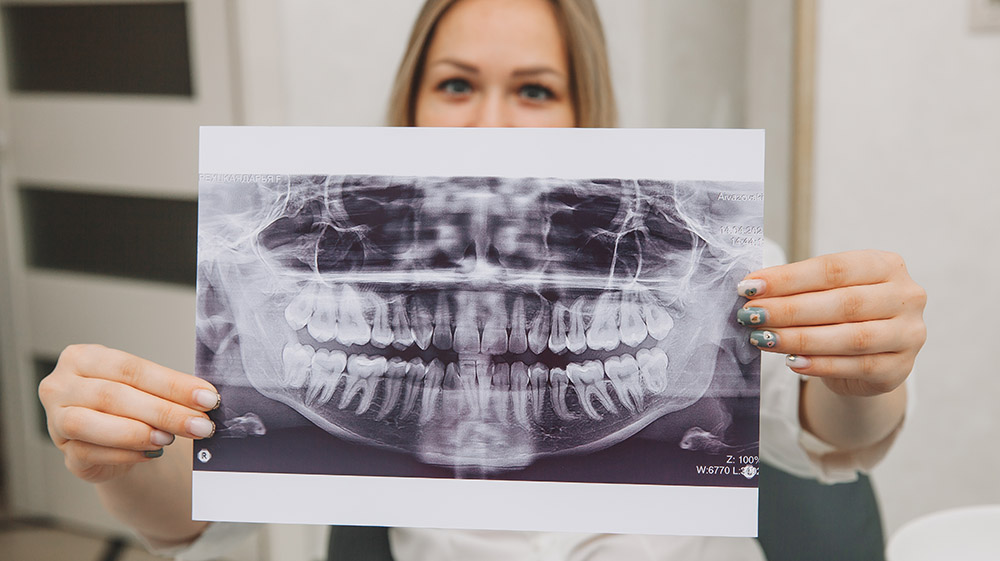 Patient beautiful girl is holding an x-ray of her teeth. medicine and dentistry concept.